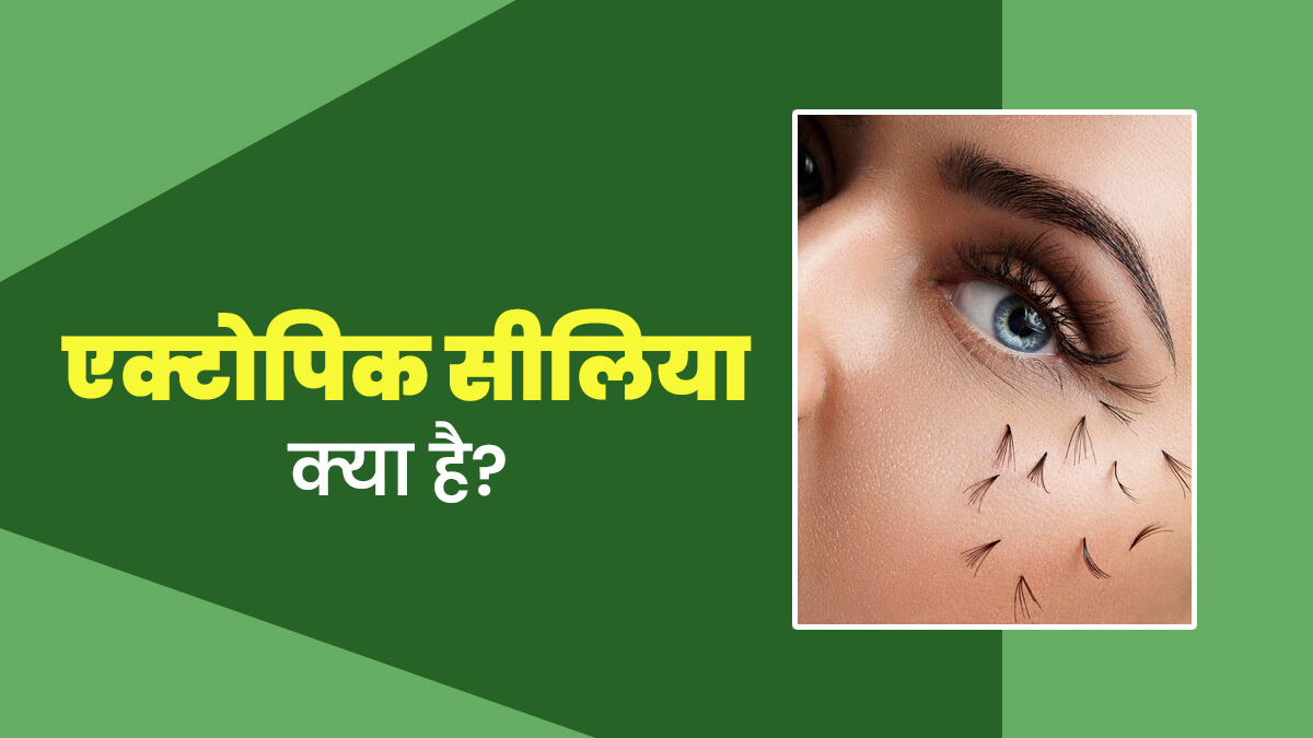 आंखों के अंदरूनी हिस्से में बाल उगना हो सकता है Ectopic Cilia का संकेत, डॉक्टर से जानें इस बीमारी के बारे में