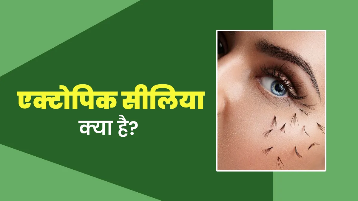 आंखों के अंदरूनी हिस्से में बाल उगना हो सकता है Ectopic Cilia का संकेत, डॉक्टर से जानें इस बीमारी के बारे में