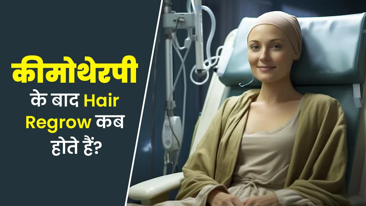 कीमोथेरेपी करवाने के बाद बाल दोबारा कितने समय में उगते हैं? जानें डॉक्टर से