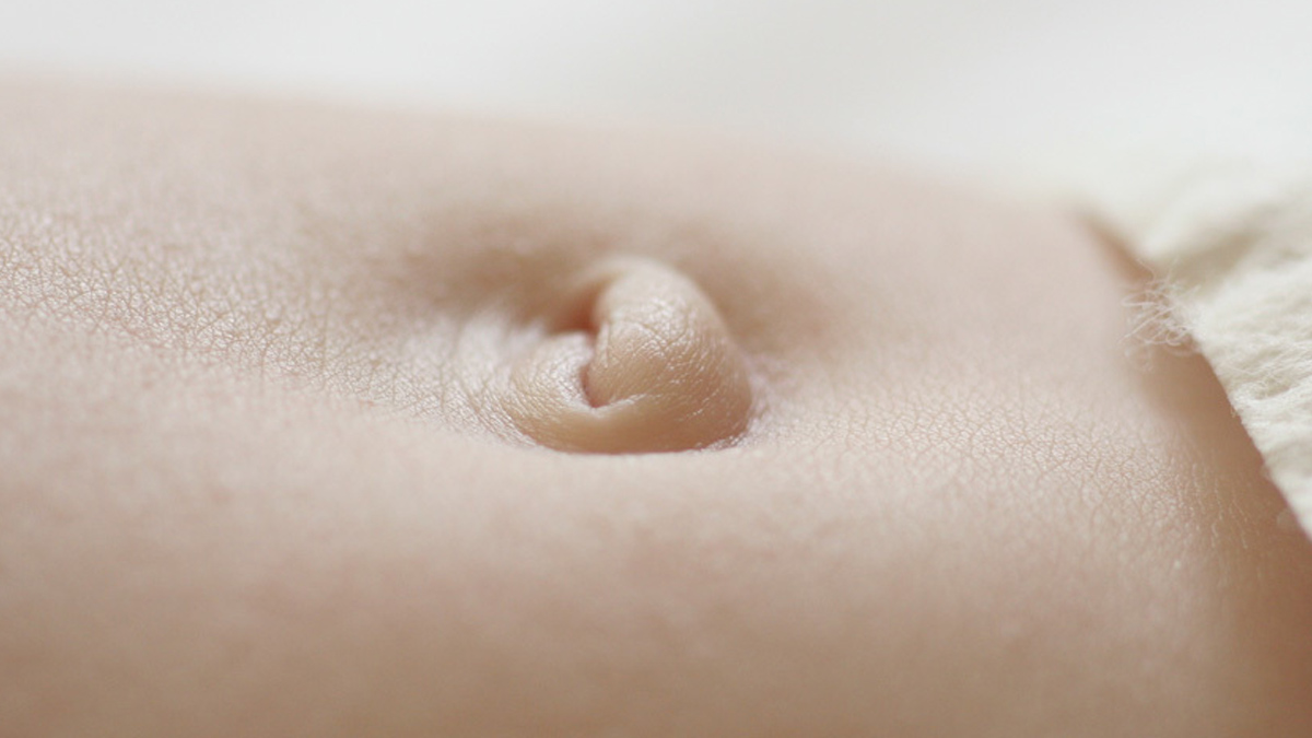 Causes Of Outie Belly Button In Hindi causes-of-outie-belly-button-in