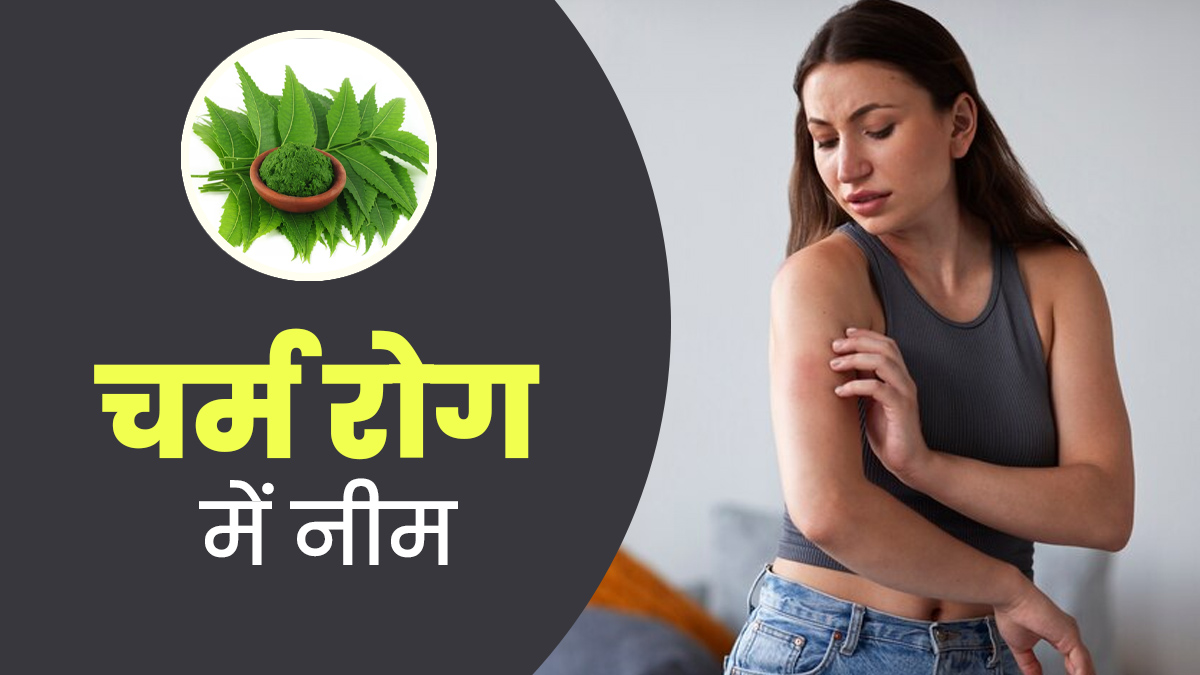 चर्म रोग में नीम का उपयोग कैसे करें? एक्सपर्ट से जानें