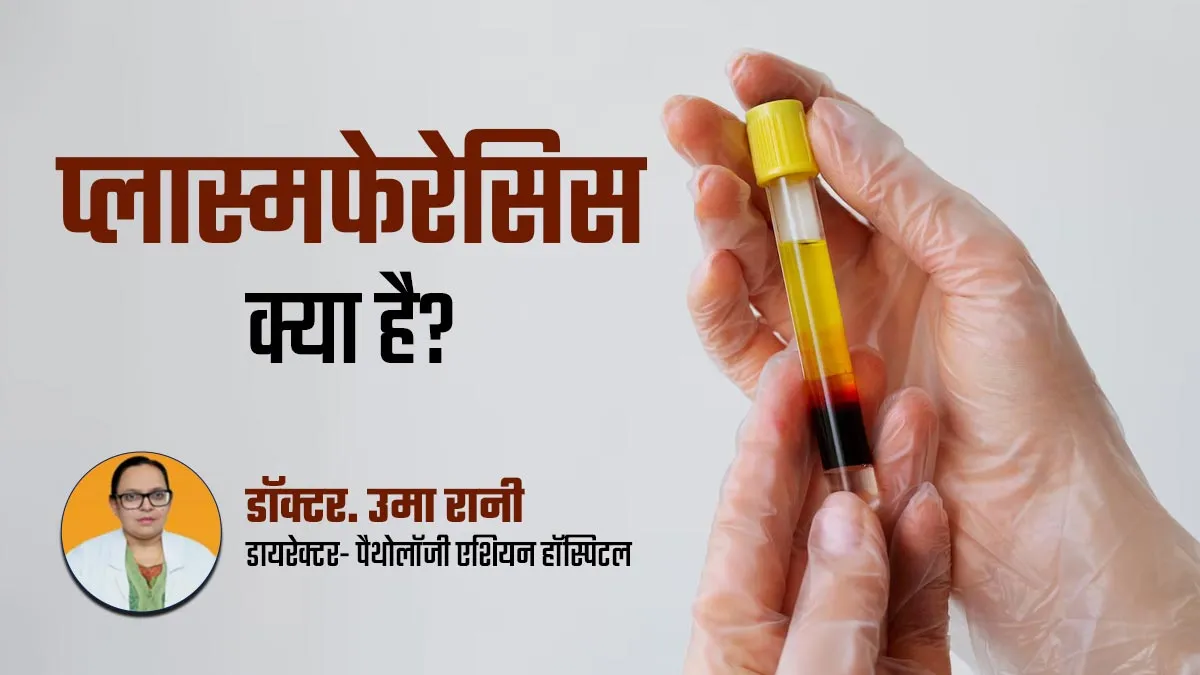 प्लास्मफेरेसिस या प्लाज्मा एक्सचेंज क्या है? डॉक्टर से जानें कब होती है इसकी जरूरत