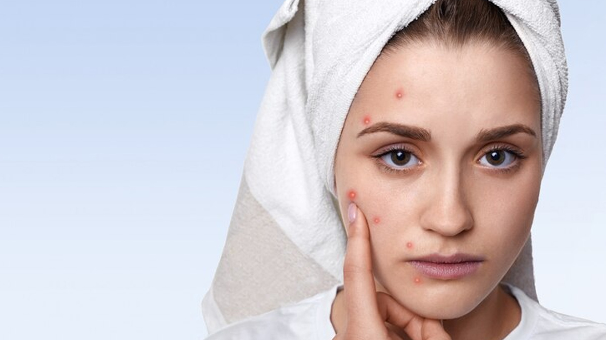 does poor oral health affect the skin in hindi 1