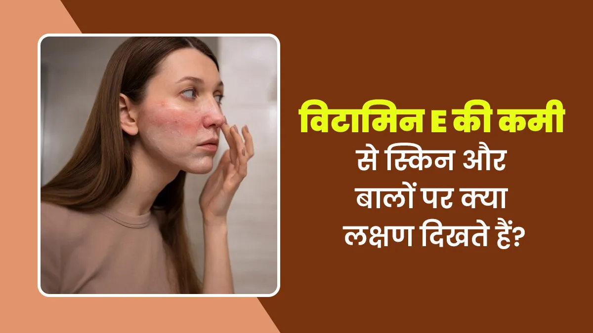 विटामिन E की कमी से स्किन और बालों पर दिखते हैं ये लक्षण, जानें इससे बचाव का तरीका