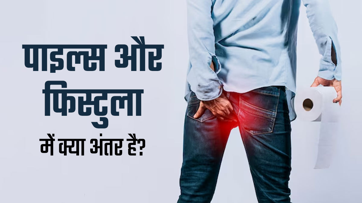फिस्टुला और पाइल्स में क्या अंतर है? डॉक्टर से जानें सही जानकारी