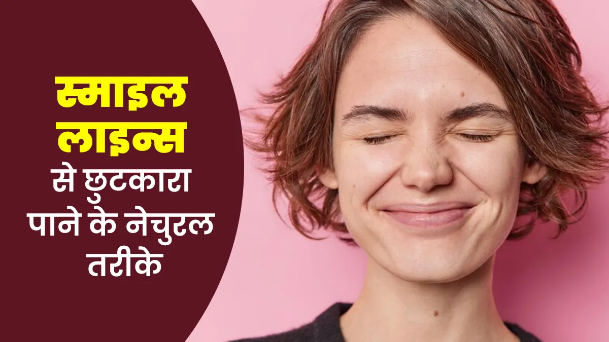 स्माइल लाइन्स से छुटकारा कैसे पाएं? डॉक्टर से जानें नेचुरल तरीके