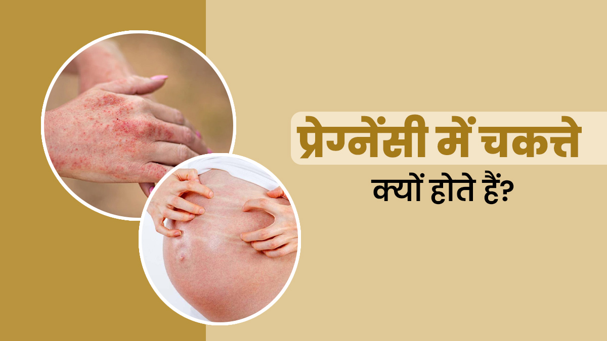 प्रेग्नेंसी में चकत्ते क्यों होने के क्या कारण हो सकते हैं? एक्सपर्ट से जानें बचने के उपाय
