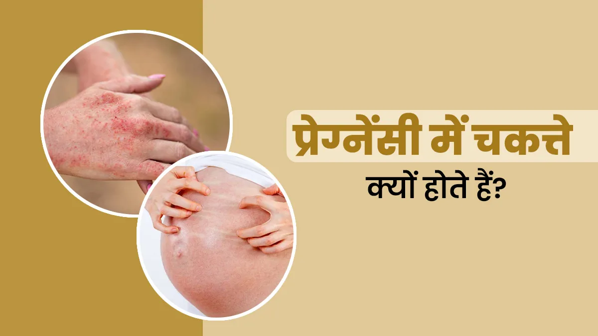 प्रेग्नेंसी में चकत्ते क्यों होने के क्या कारण हो सकते हैं? एक्सपर्ट से जानें बचने के उपाय