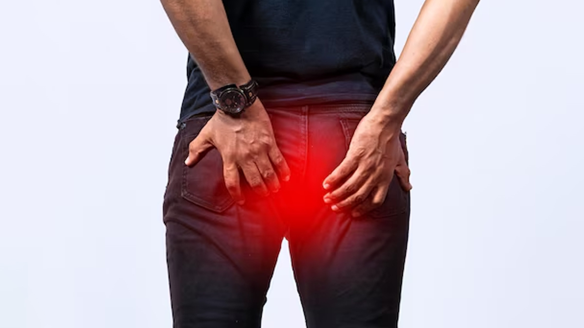 Difference between Piles and Fistula