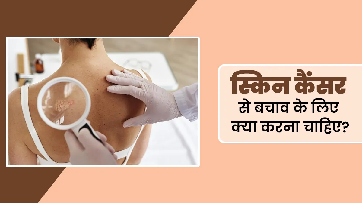 स्किन कैंसर से बचाव के लिए क्या करना चाहिए? डॉक्टर से जानें