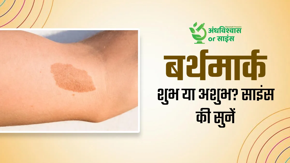 बर्थमार्क होना शुभ या अशुभ? जानें क्या कहता है साइंस