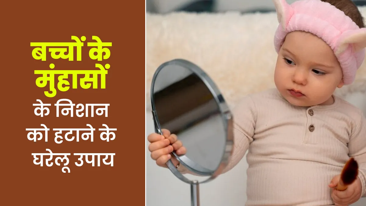 बच्चों में मुंहासों के निशान हटाने के लिए अपनाएं ये 5 घरेलू उपाय, मिलेगा फायदा