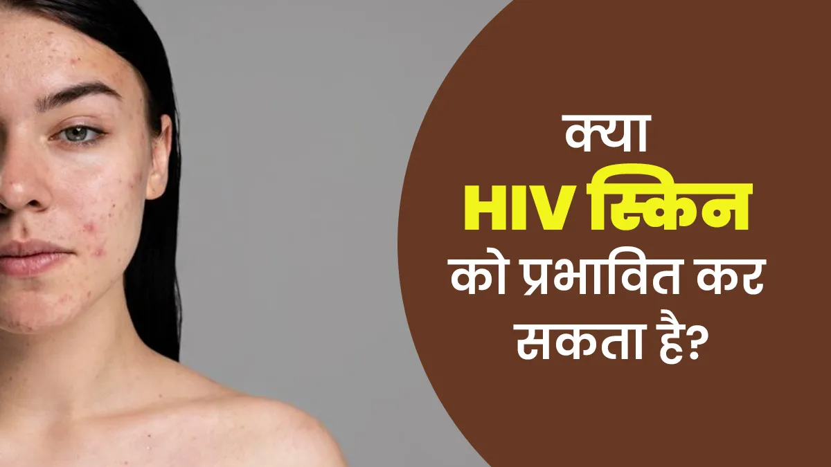 एचआईवी (HIV) स्किन को कैसे प्रभावित करता है? जानें डॉक्टर से