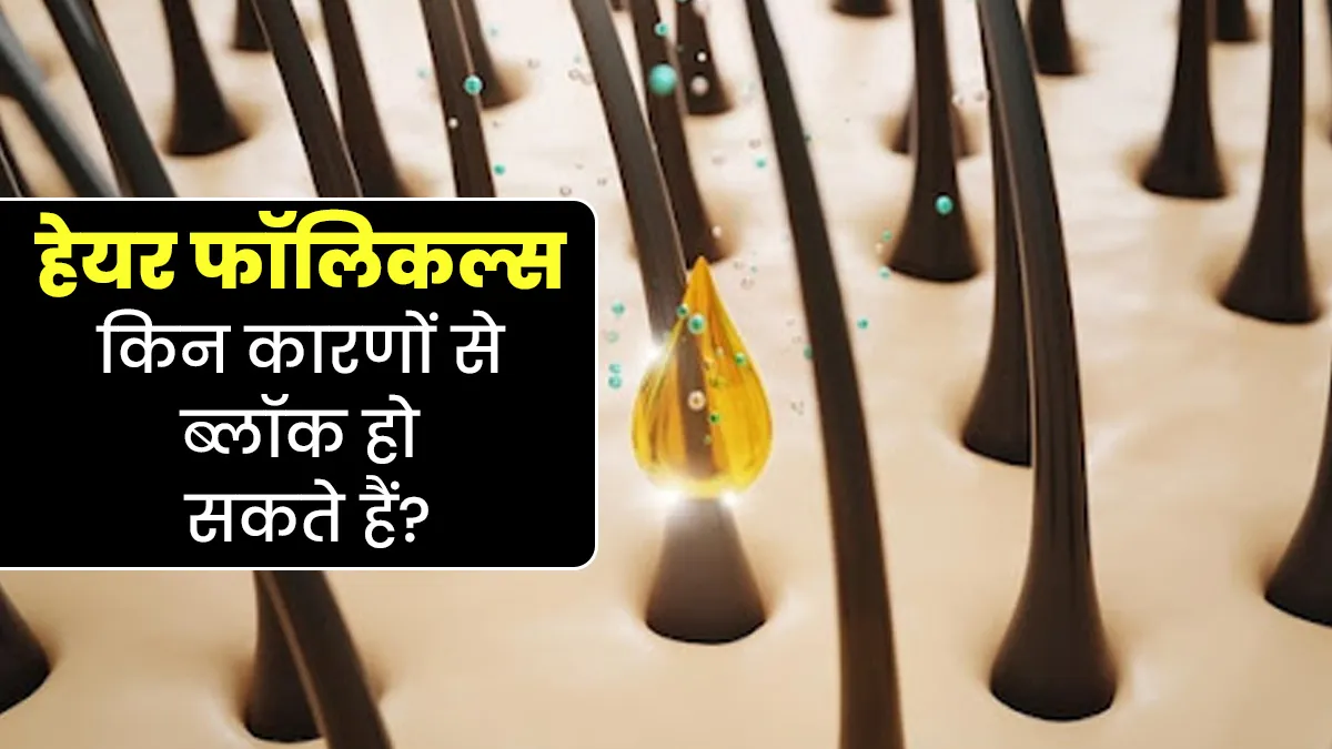 किन 7 कारणों से Hair Follicles हो सकते हैं ब्लॉक? जानें डॉक्टर से