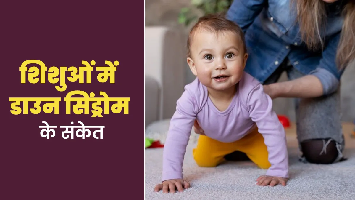 शिशुओं में डाउन सिंड्रोम होने पर कौन-से संकेत नजर आते हैं? डॉक्टर से जानें जवाब