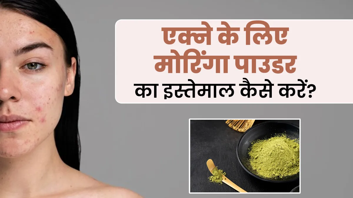 एक्ने कम करने में मददगार है मोरिंगा पाउडर, एक्सपर्ट से जानें इस्तेमाल का तरीका