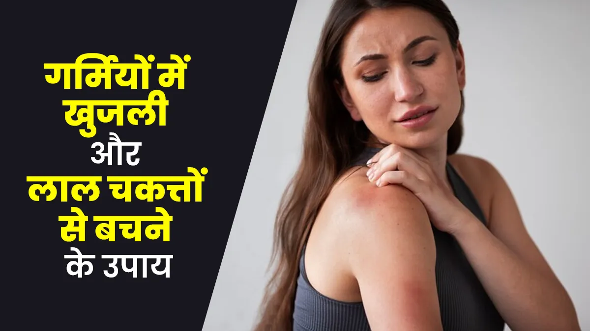 गर्मियों में खुजली और लाल चकत्तों से बचने के उपाय, एक्सपर्ट से जानें