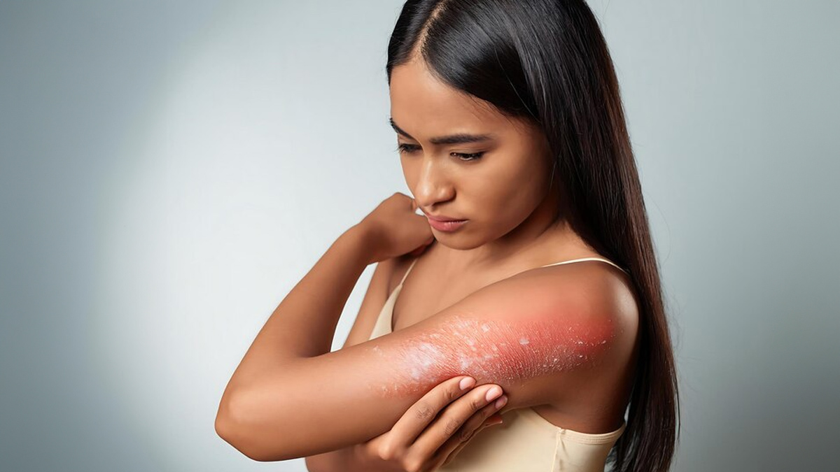 tips to avoid itching and red rashes in summer in hindi 01