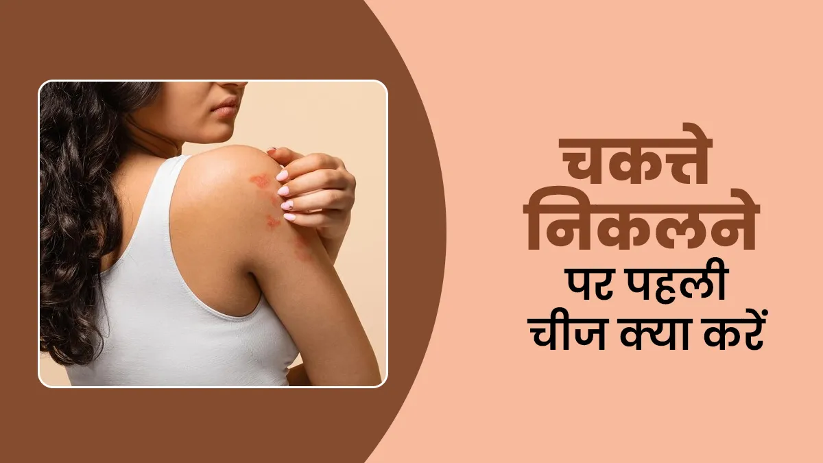 स्किन में चकत्ते निकलने पर पहली चीज क्या करें? एक्सपर्ट से जानें