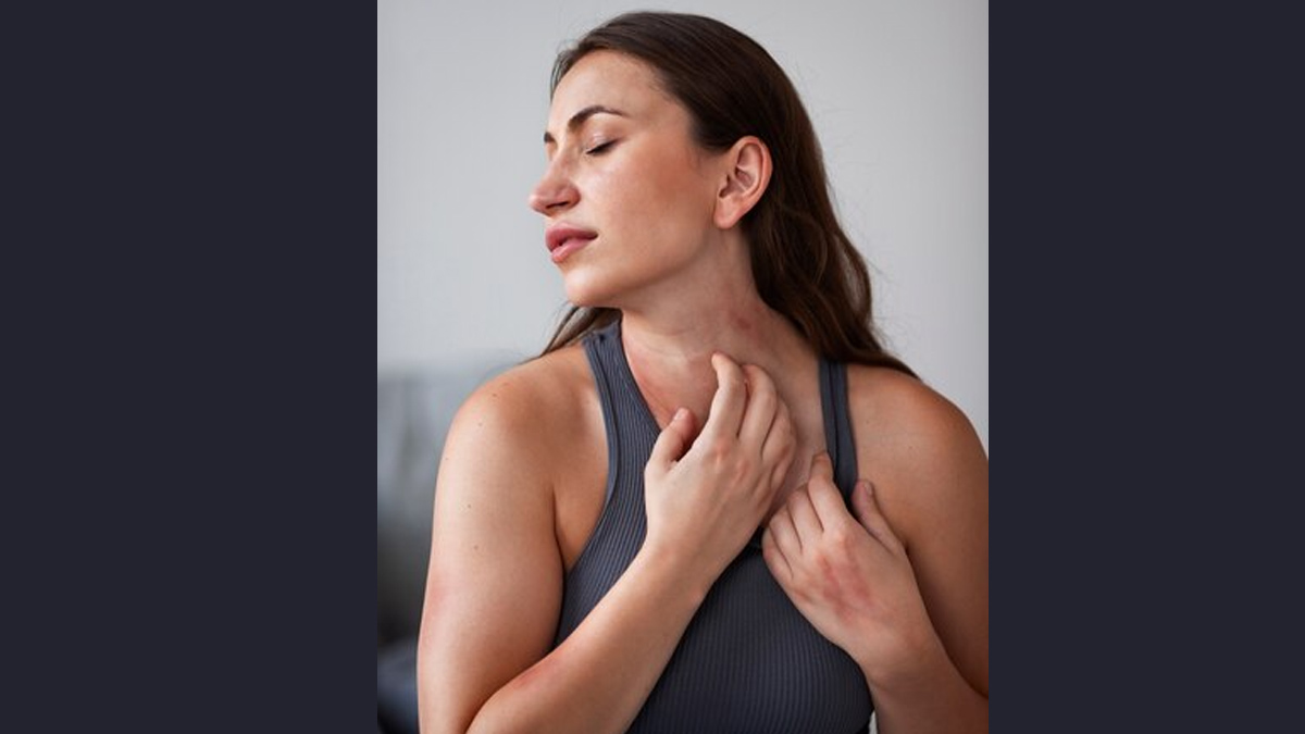 sudden skin rash remedies