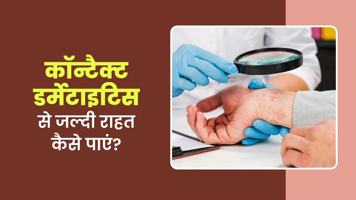 कॉन्टैक्ट डर्मेटाइटिस से जल्दी राहत कैसे पाएं? जानें डॉक्टर से