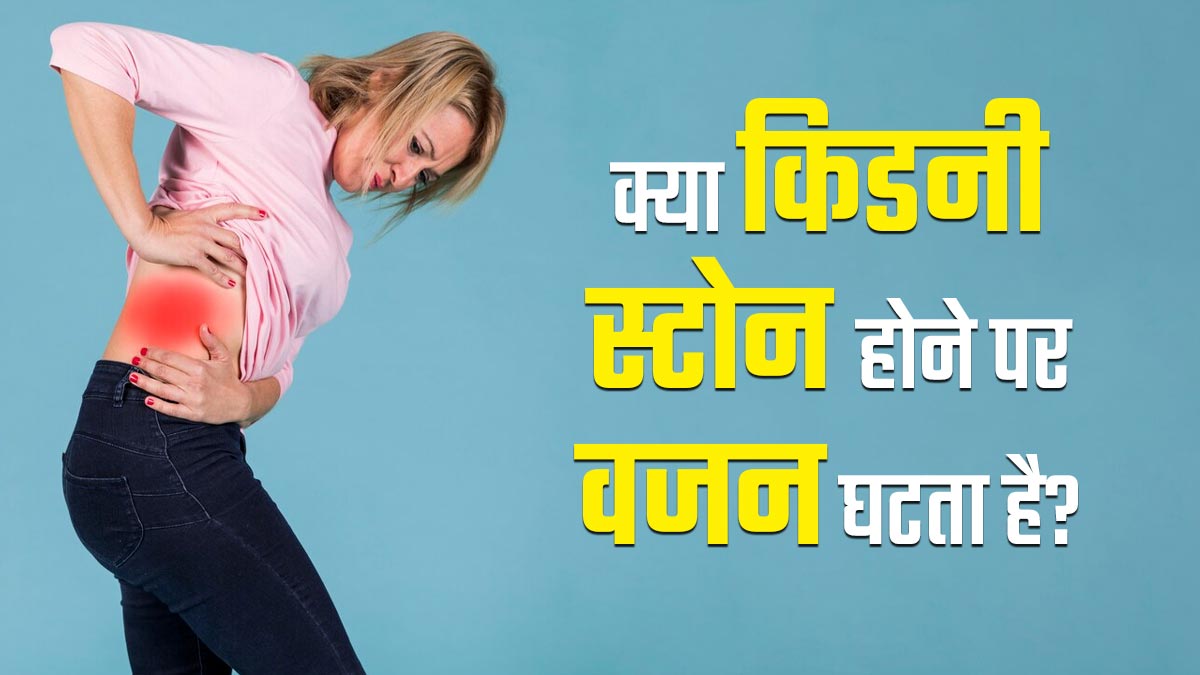 क्या वाकई किडनी स्टोन होने पर वजन घटने लगता है? जानें डॉक्टर से