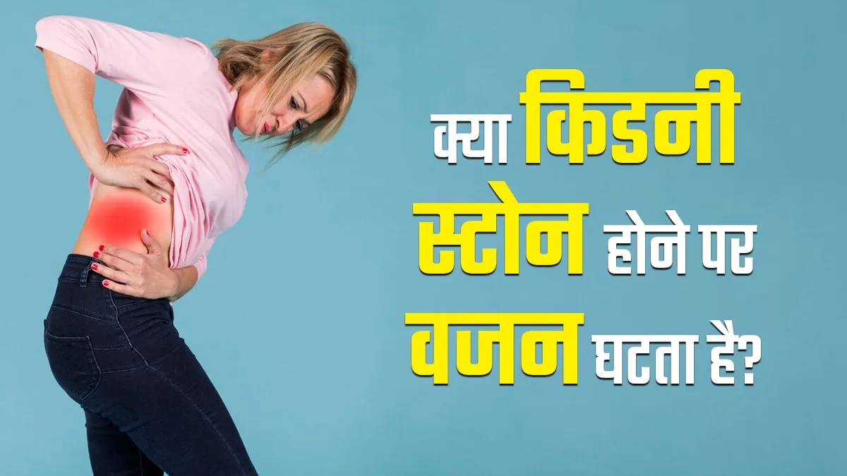 क्या वाकई किडनी स्टोन होने पर वजन घटने लगता है? जानें डॉक्टर से