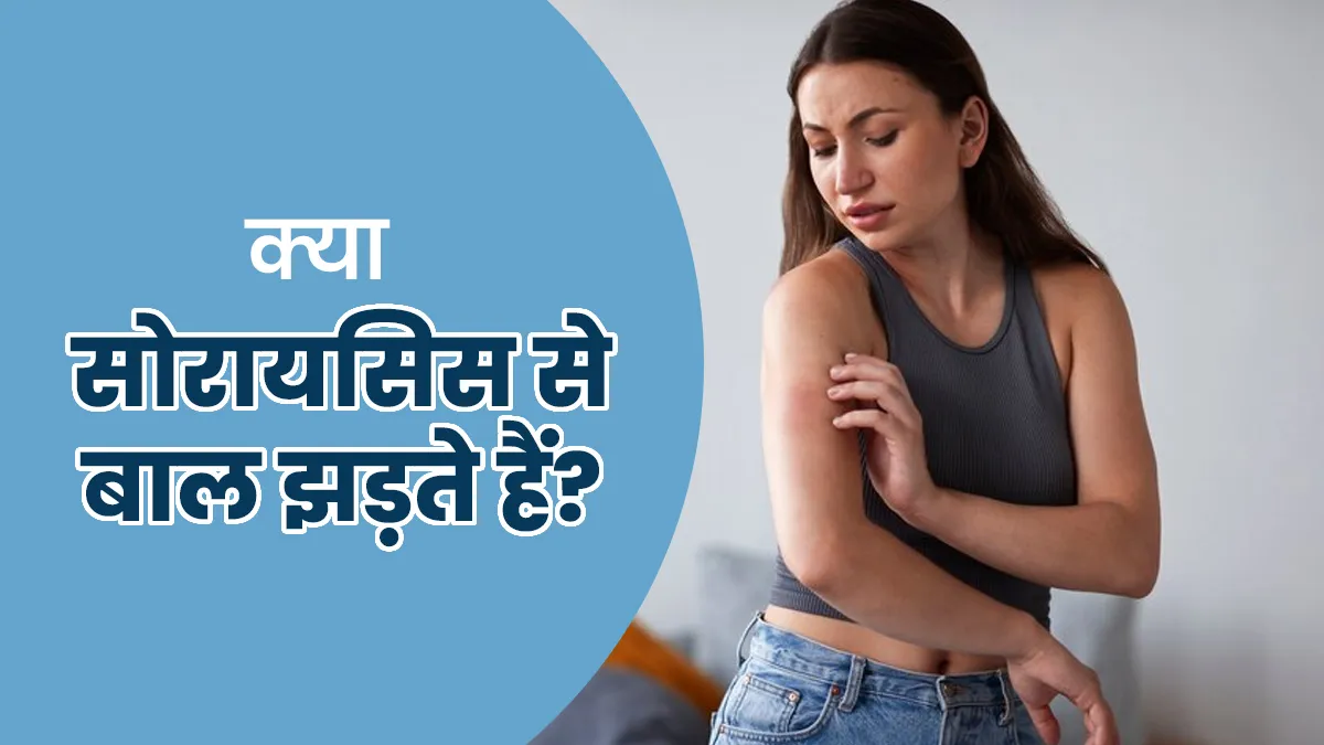 क्या सोरायसिस बालों के झड़ने का कारण बनता है? जानें डॉक्टर से