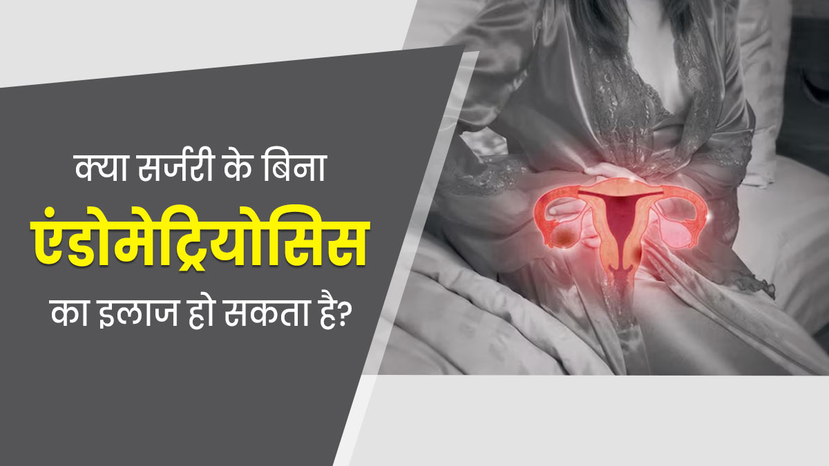 क्या सर्जरी के बिना एंडोमेट्रियोसिस का इलाज संभव है? डॉक्टर से जानें