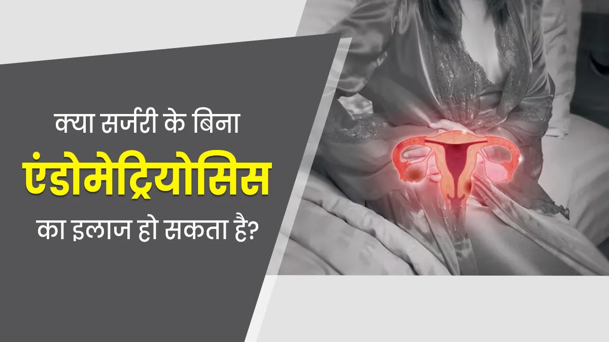 क्या सर्जरी के बिना एंडोमेट्रियोसिस का इलाज संभव है? डॉक्टर से जानें