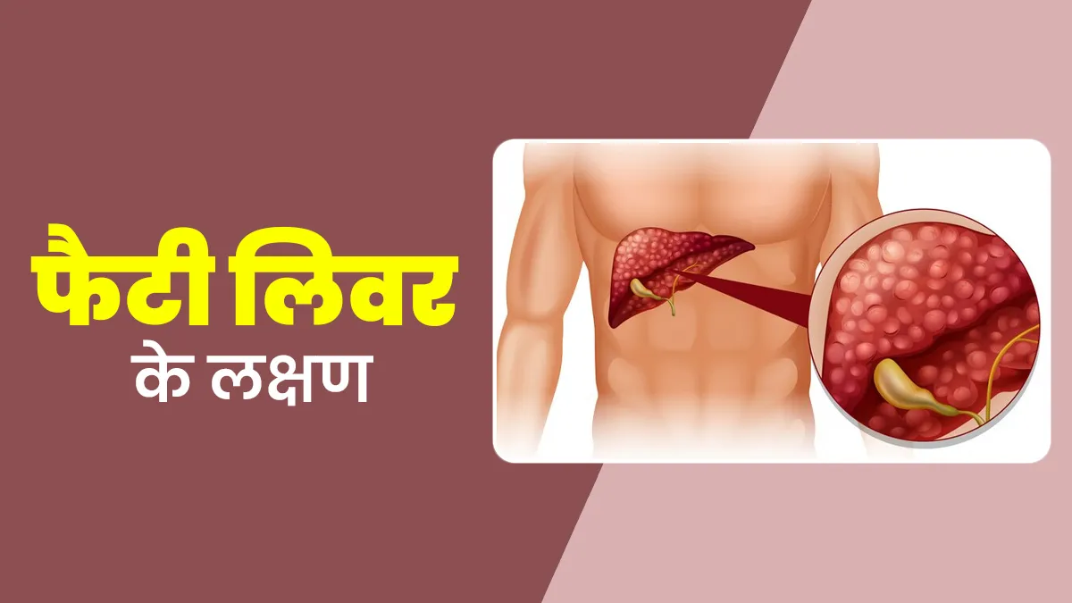 ये 5 संकेत बताते हैं आपको हो सकता है फैटी लिवर का खतरा, जानें