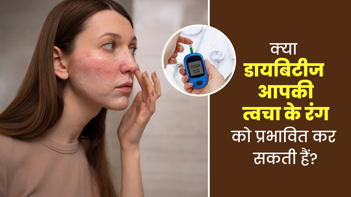 क्या डायबिटीज आपकी त्वचा के रंग को प्रभावित कर सकती हैं? डॉक्टर से जानें