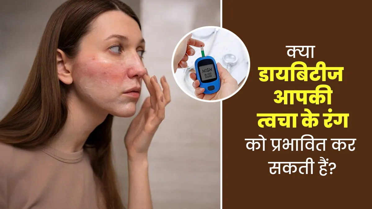 क्या डायबिटीज आपकी त्वचा के रंग को प्रभावित कर सकती हैं? डॉक्टर से जानें