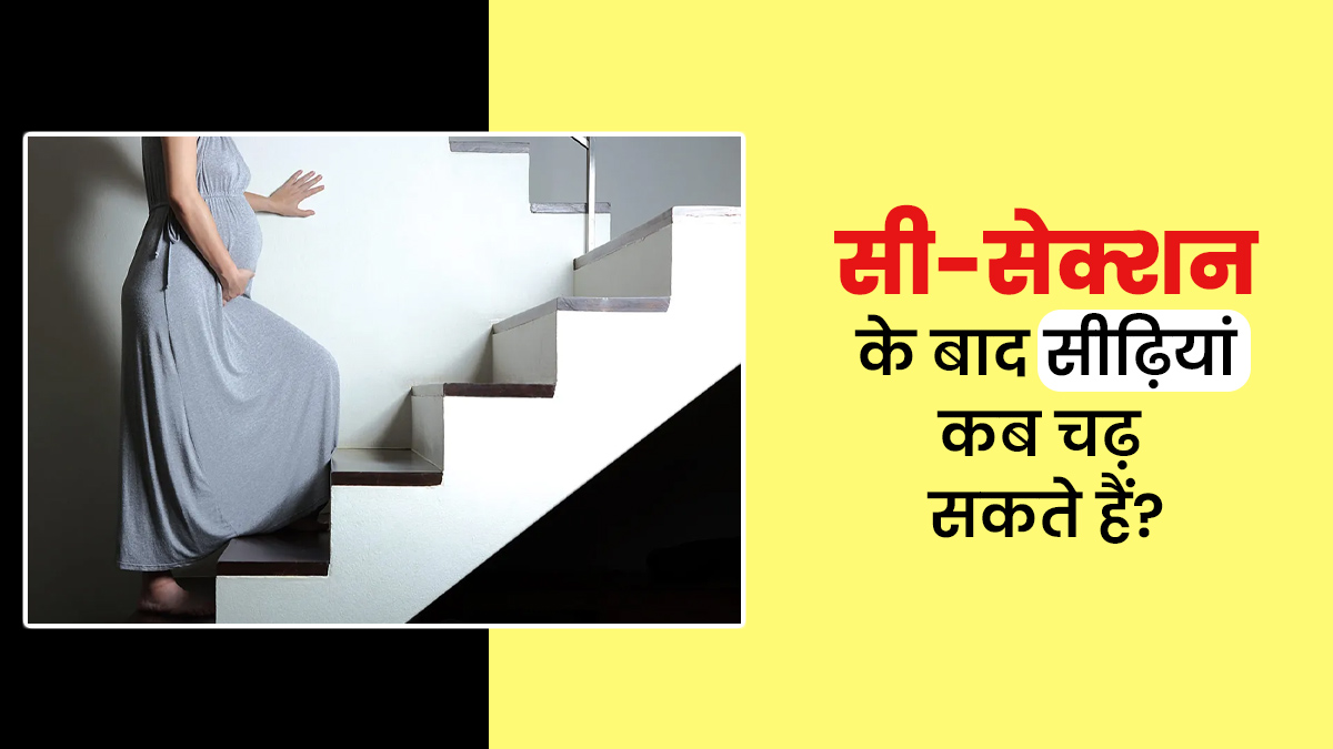 सी-सेक्शन के बाद सीढ़ियां कब चढ़ सकते हैं? एक्सपर्ट से जानें