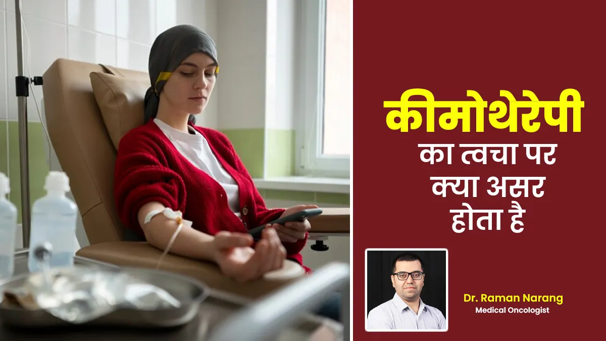 कैंसर के इलाज में दी जाती है कीमोथेरेपी, जानें इसका त्वचा पर क्या असर हो सकता है