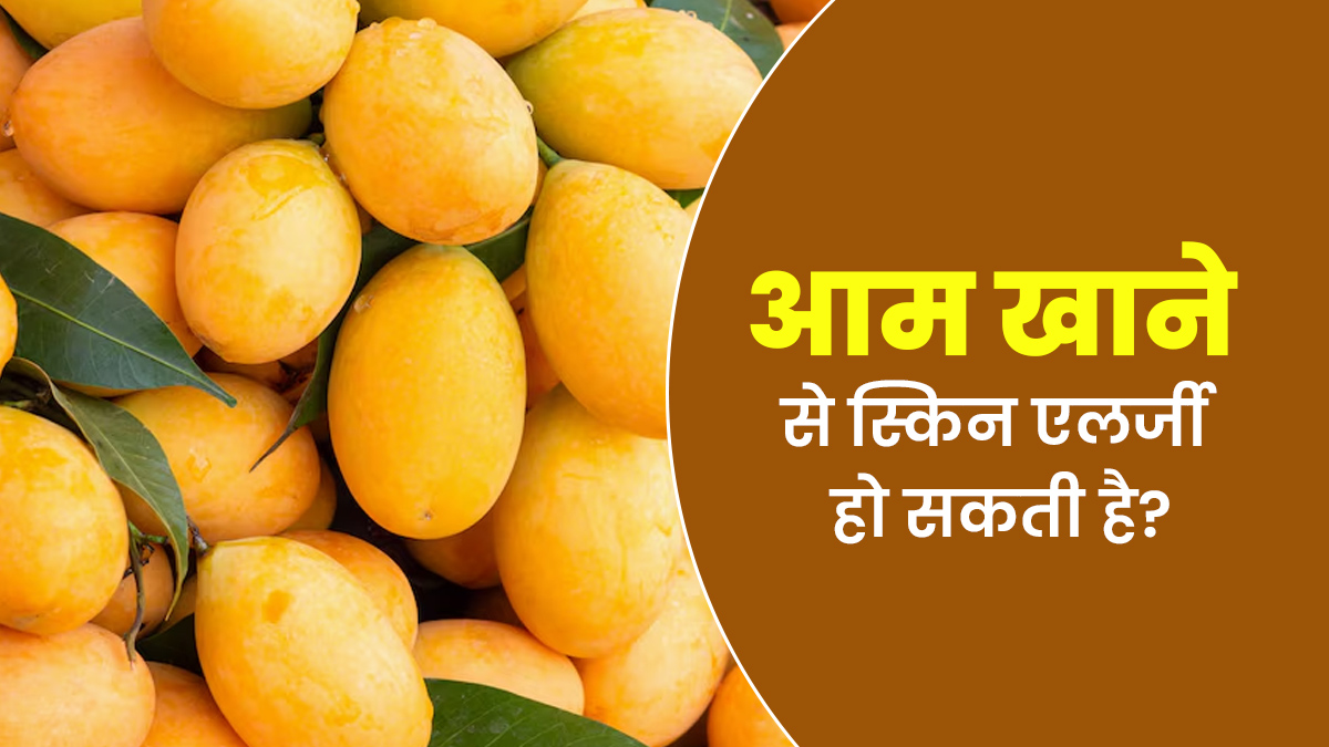 क्या आम के चटकारे बन सकते हैं स्किन एलर्जी की वजह? जानें डॉक्टर की क्या है राय