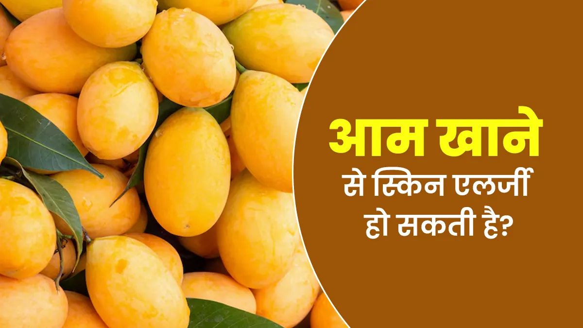 क्या आम के चटकारे बन सकते हैं स्किन एलर्जी की वजह? जानें डॉक्टर की क्या है राय