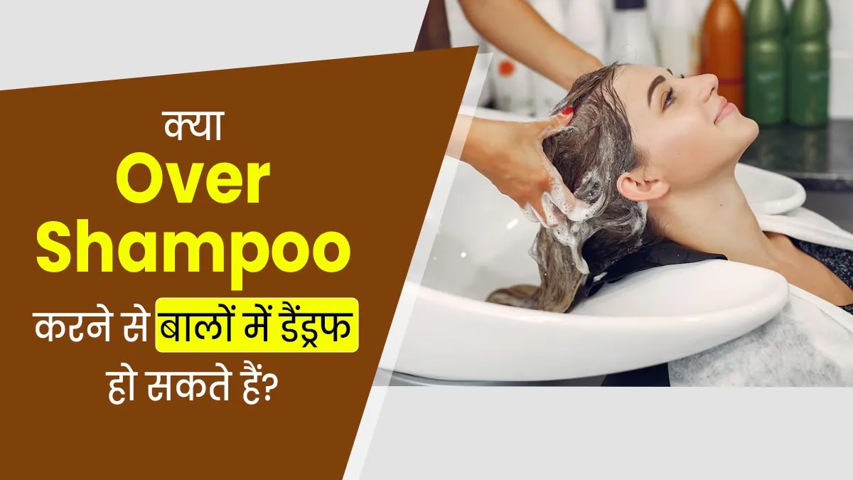 क्या ज्यादा शैंपू करने से बालों में डैंड्रफ की समस्या हो सकती है? जानें एक्सपर्ट से