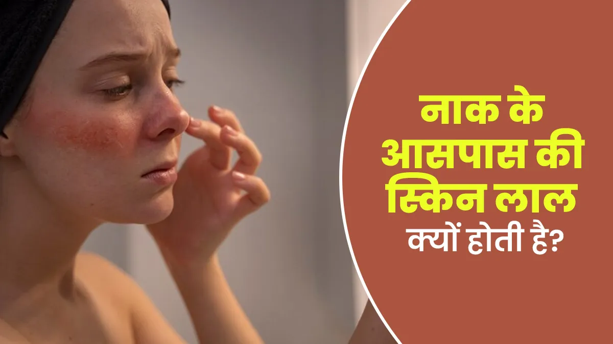 नाक के आसपास की स्किन लाल होने के पीछे क्या हैं कारण? जानें डॉक्टर से