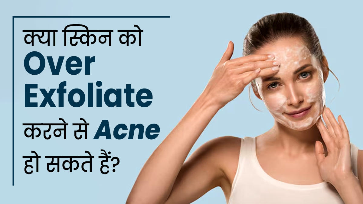 क्या स्किन को बार-बार एक्सफोलिएट करने से कील-मुंहासों की दिक्कत हो सकती है? बता रहे हैं डॉक्टर