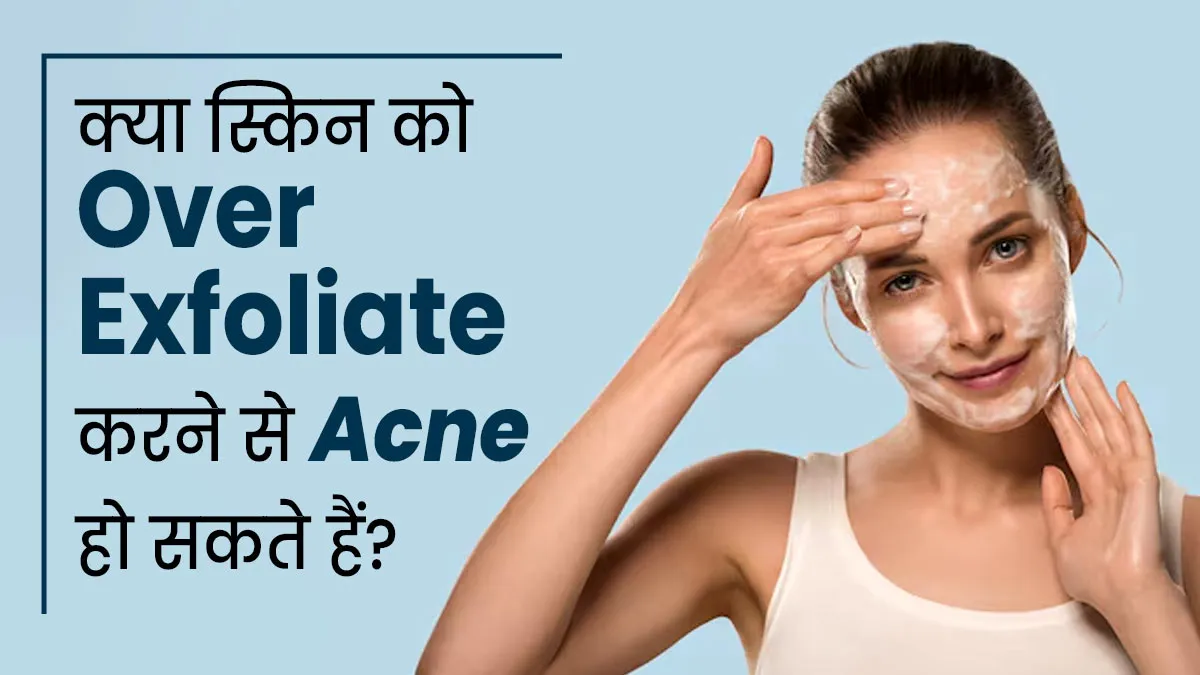 क्या स्किन को बार-बार एक्सफोलिएट करने से कील-मुंहासों की दिक्कत हो सकती है? बता रहे हैं डॉक्टर
