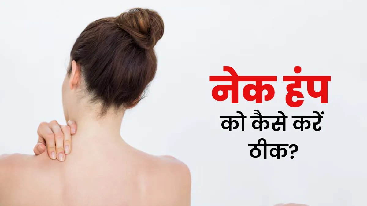 नेक हंप का क्या कारण है और इससे बचाव कैसे करें? जानें डॉक्टर से