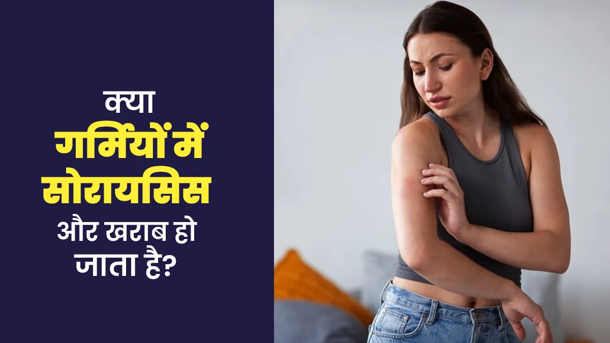 गर्मियों में सोरायसिस की समस्या बढ़ती है या कम होती है? जानें डॉक्टर से
