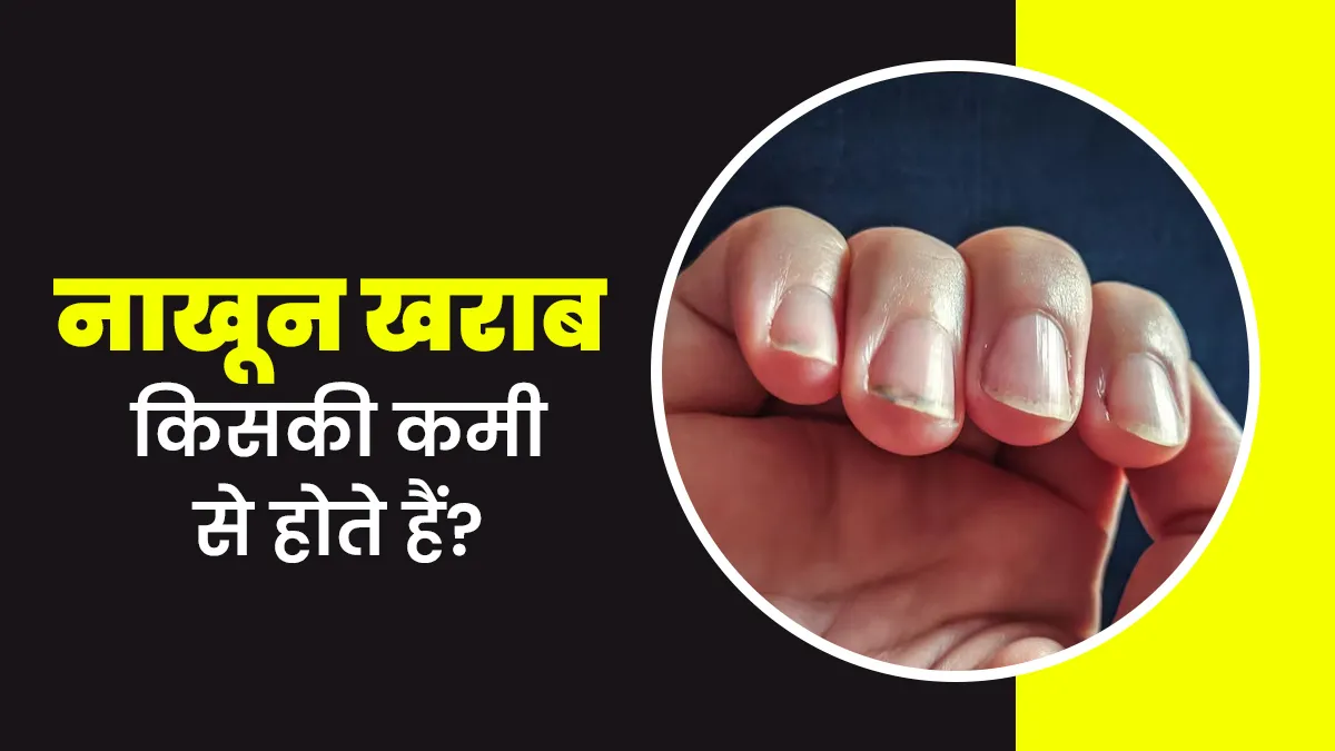 नाखून खराब किसकी कमी से होते हैं? जानें डॉक्टर से