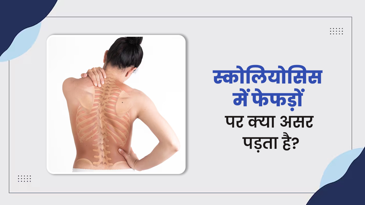 क्या रीढ़ की हड्डी से जुड़ी समस्या (स्कोलियोसिस) आपके फेफड़ों को प्रभावित कर सकती है? डॉक्टर से जानें
