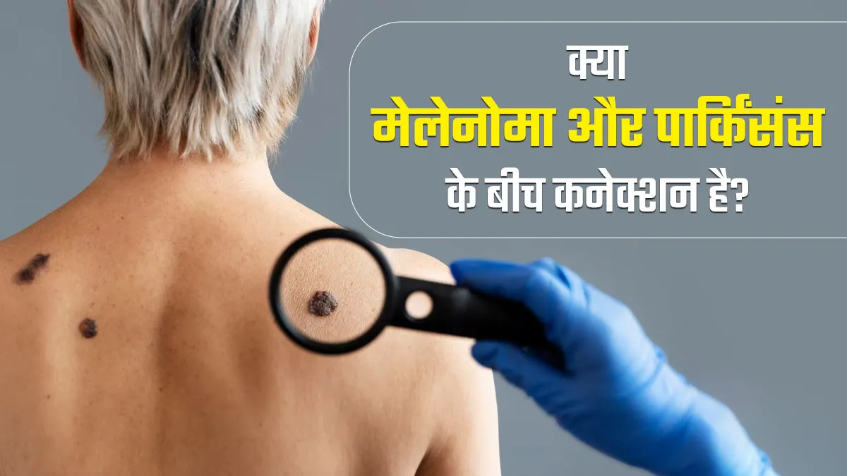 क्या मेलेनोमा और पार्किंसंस के बीच कोई कनेक्शन है? डॉक्टर से जानें