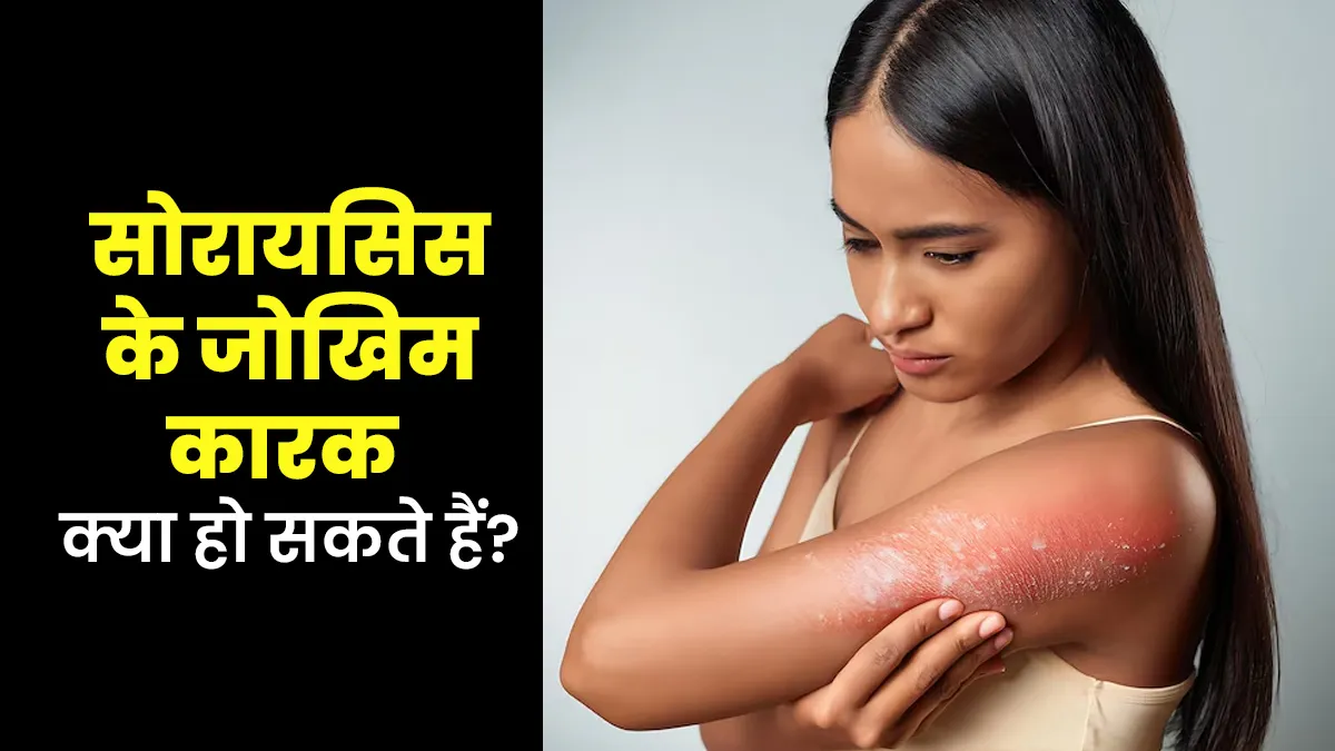 सोरायसिस का जोखिम बढ़ा सकते हैं ये कारक, डॉक्टर से जानें कितना गंभीर