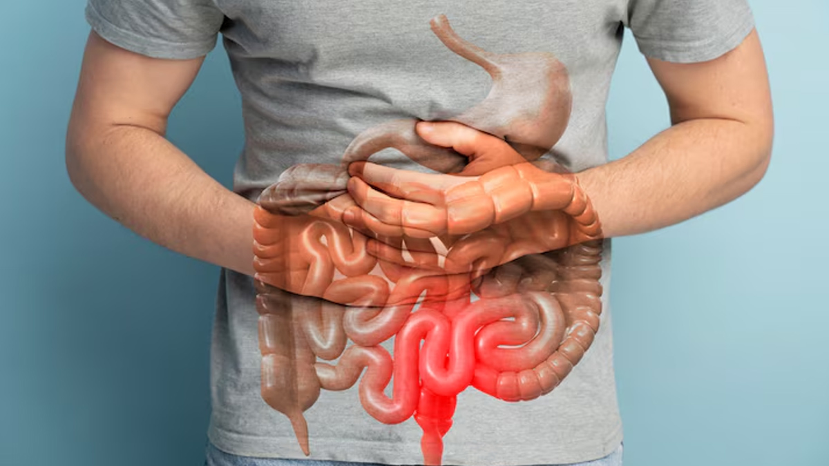 How to deal with cramps in crohn disease in