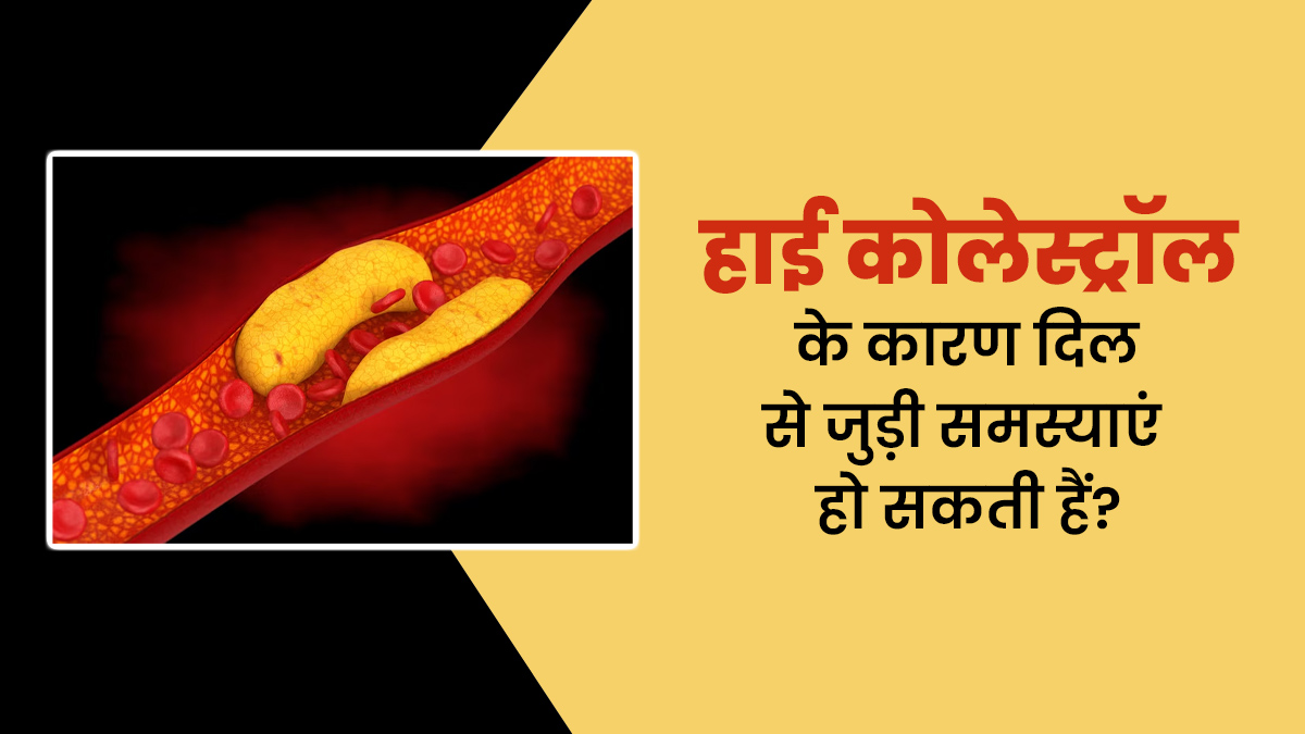 क्या हाई कोलेस्ट्रॉल के कारण दिल से जुड़ी समस्याओं का खतरा बढ़ सकता है? जानें डॉक्टर से
