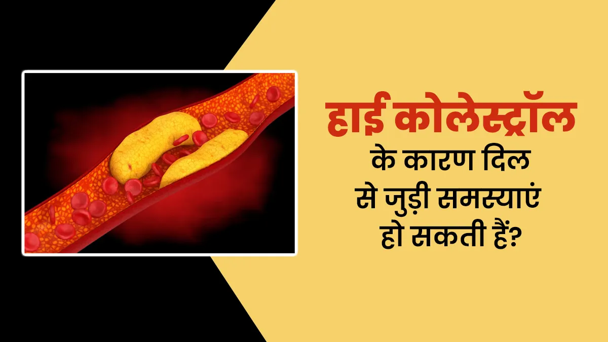 क्या हाई कोलेस्ट्रॉल के कारण दिल से जुड़ी समस्याओं का खतरा बढ़ सकता है? जानें डॉक्टर से
